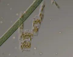 carpenter's rule diatom thumbnail 1