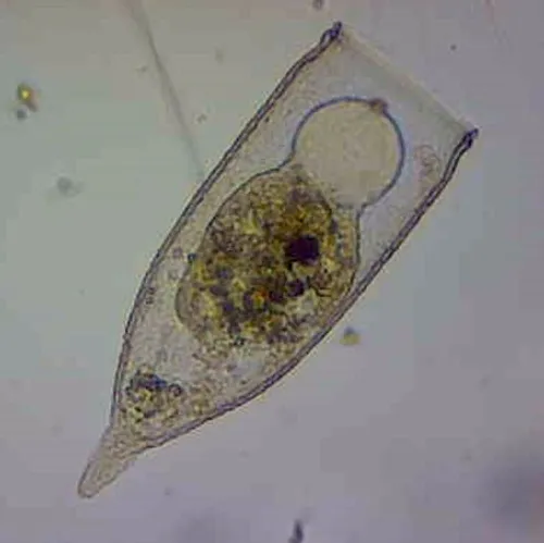 Favella ehrenbergii