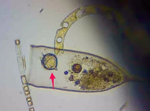 Protoperidinium steinii