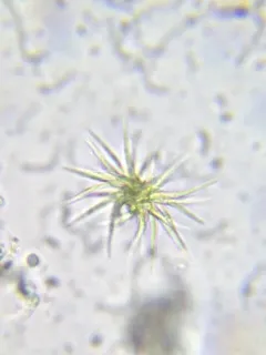 Ankistrodesmus densus thumbnail 4