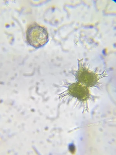 Staurastrum tohopekaligense