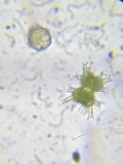 Staurastrum tohopekaligense thumbnail 1