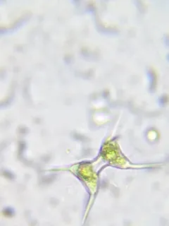 Staurodesmus extensus thumbnail 3