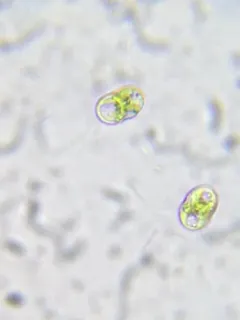 Cosmocladium constrictum thumbnail 2