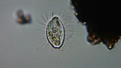 Cyclidium glaucoma thumbnail 2
