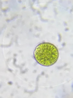 Asterococcus superbus thumbnail 2