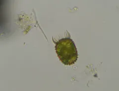 Trachelomonas armata thumbnail 3
