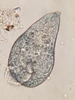 Stentor multiformis thumbnail 2