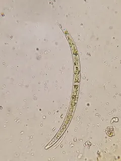 Closterium acutum thumbnail 2