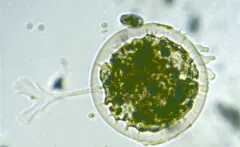 Arcella vulgaris thumbnail 3