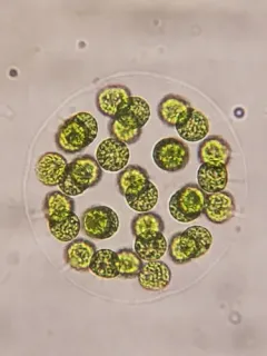 Eudorina elegans thumbnail 4