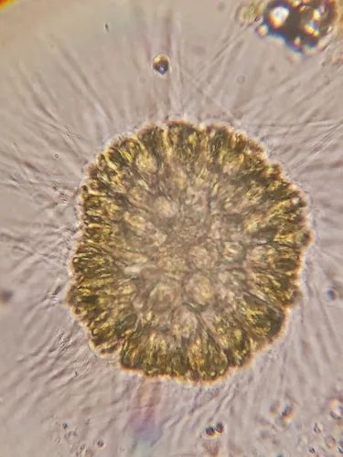 Chrysosphaerella longispina
