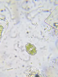 Euastrum elegans thumbnail 2