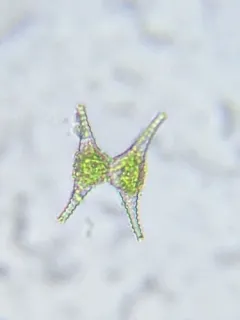 Staurastrum anatinum thumbnail 3