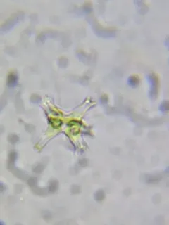 Staurastrum brachiatum thumbnail 2