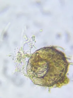 Centropyxis aculeata thumbnail 3