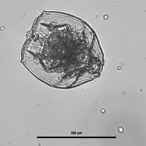 Brachionus angularis