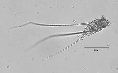 Filinia terminalis