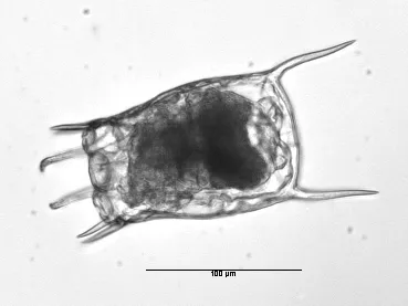 Keratella quadrata