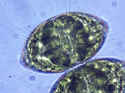 Staurodesmus brevispina