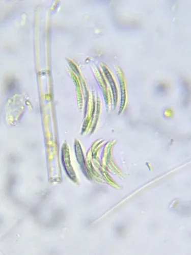 Quadrigula closterioides