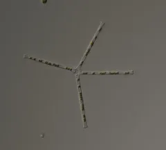 Asterionella formosa thumbnail 1