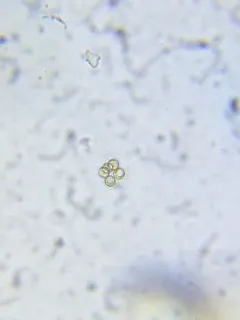 Micractinium pusillum thumbnail 2