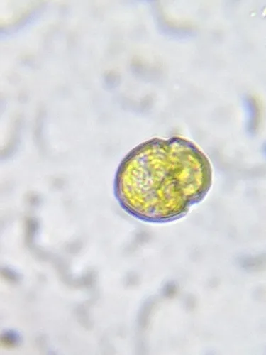 Parvodinium umbonatum