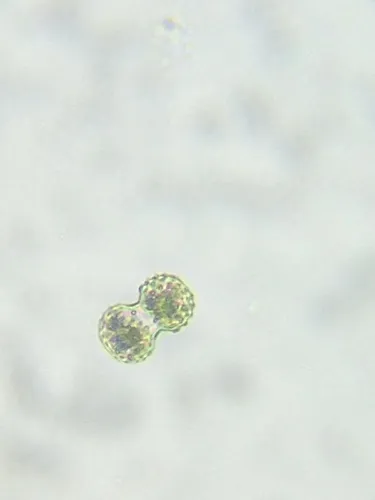 Cosmarium excavatum