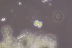 Cosmarium porteanum thumbnail 1