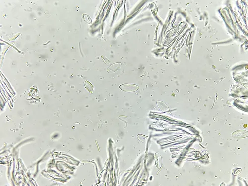 Lempholemma chalazanum