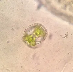 Staurastrum cerastes thumbnail 4