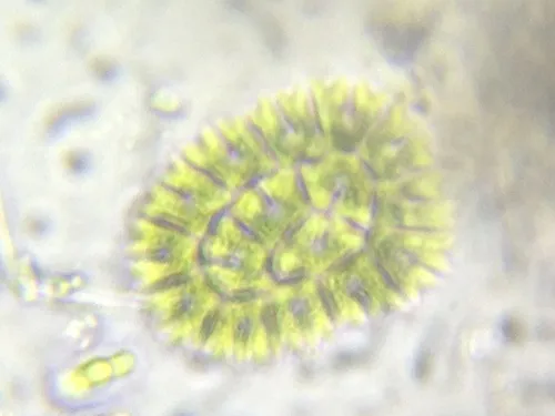 Parapediastrum biradiatum