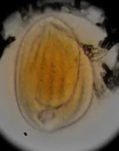 Phacodinium metchnikoffi thumbnail 4