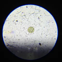 Coelastrum pulchrum thumbnail 3