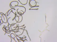Dolichospermum flosaquae thumbnail 2