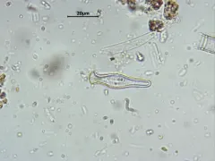 Gomphonema truncatum thumbnail 3