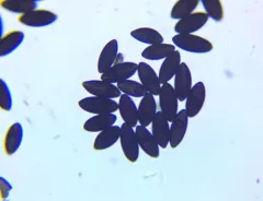 Biscogniauxia mediterranea thumbnail 4