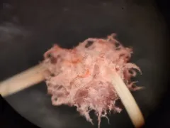 pink patch thumbnail 1