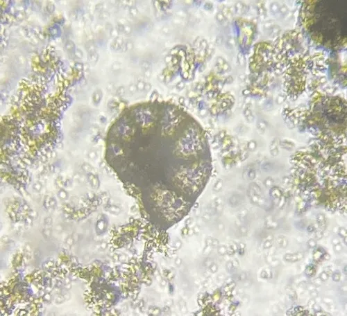 Nonion umbilicatulum