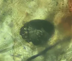Scabies Mite thumbnail 2
