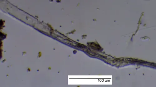 Aspidisca turrita