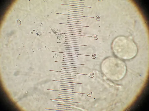 Tremella mesenterella