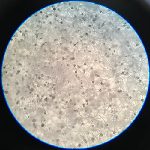 Black Bread Mold
