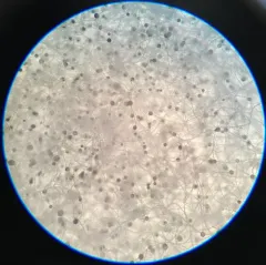 Black Bread Mold thumbnail 1