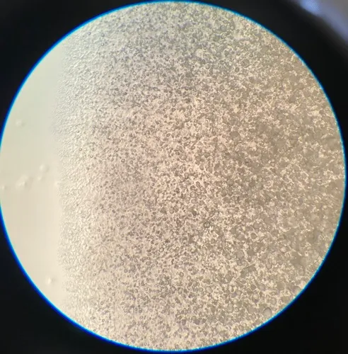 Mucor racemosus