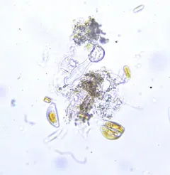 Gomphonema truncatum thumbnail 4