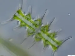 Micrasterias muricata thumbnail 3