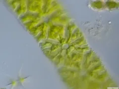 Micrasterias foliacea thumbnail 2