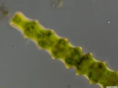 Pleurotaenium nodosum thumbnail 2